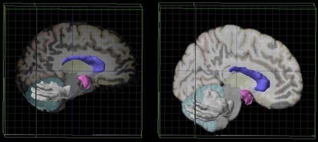 Evolution: it can also depend on a single gene