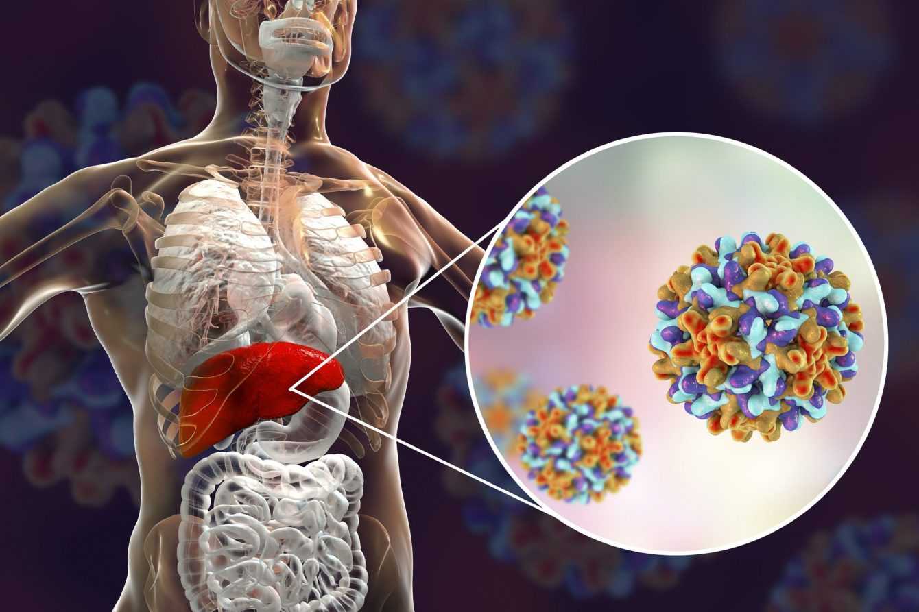 Hepatitis C: a promising discovery to cure it