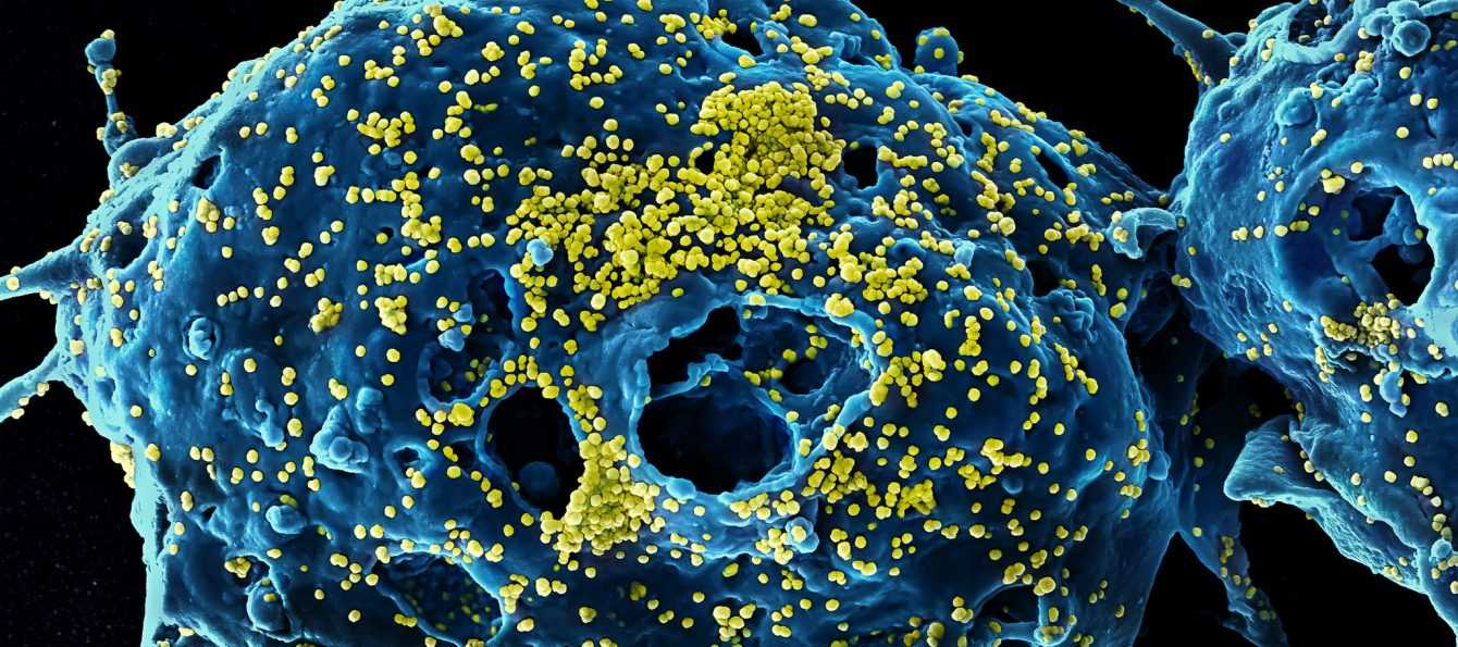 Hepatitis C: a promising discovery to cure it