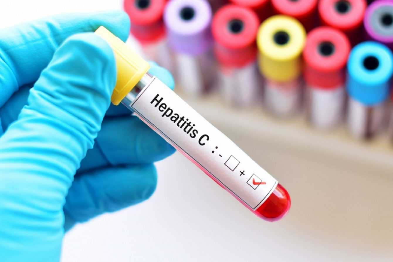 Hepatitis C: a promising discovery to cure it