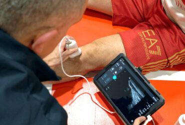 Philips: la tecnologia al servizio dello sport per gestire gli infortuni sul campo thumbnail