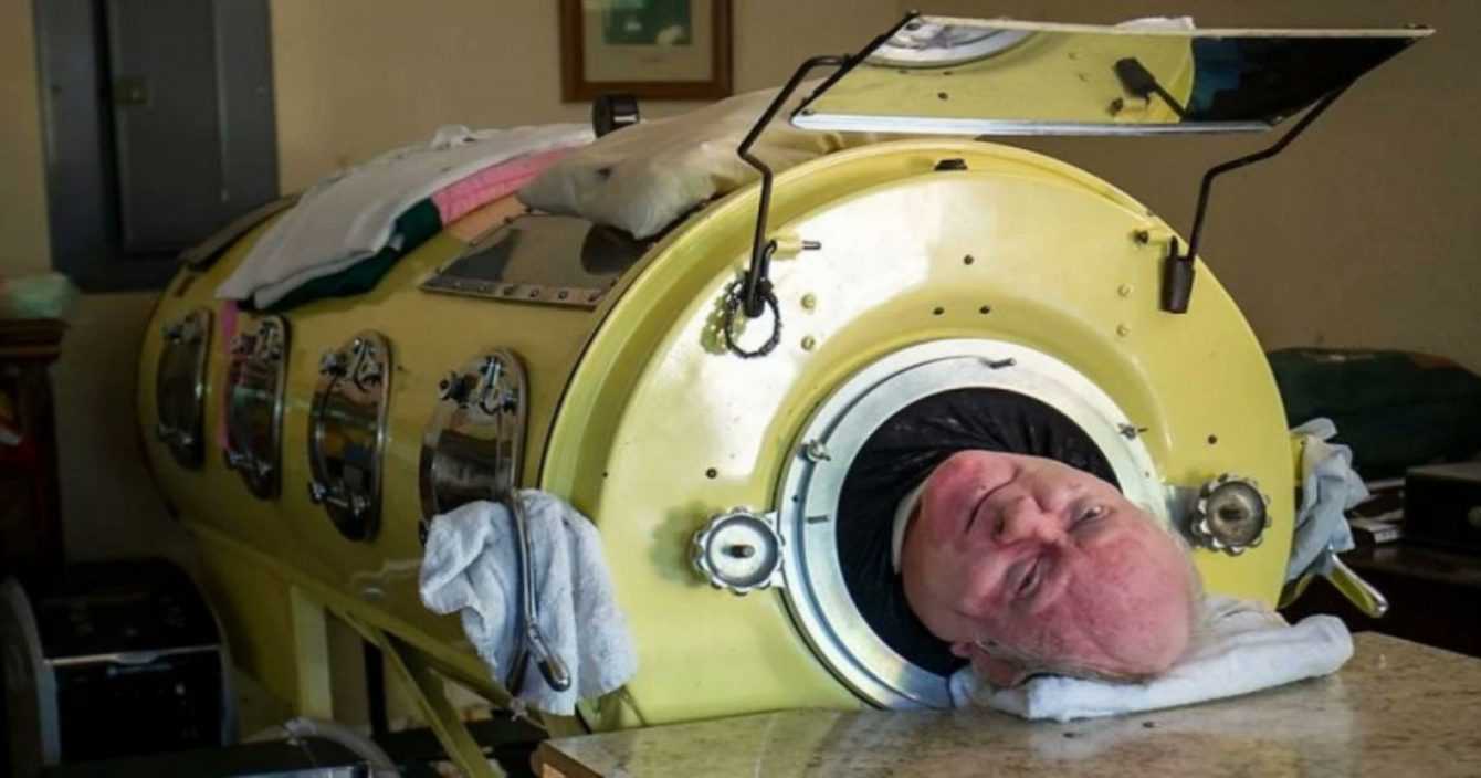 Iron lung: what it is and how it works